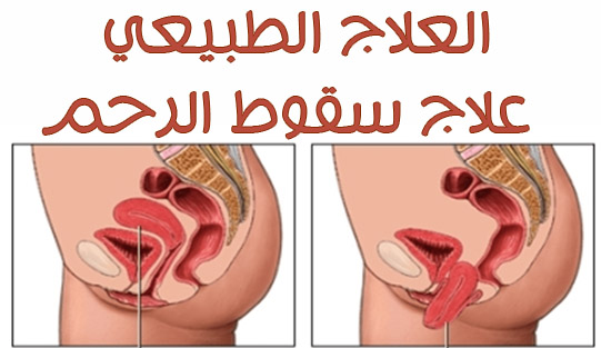 اعراض نزول الرحم،اسباب نزول الرحم و مدي خطوره ذلك 3258 1