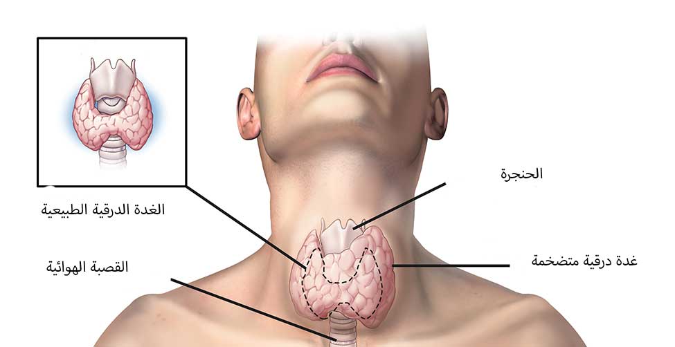 اعراض الغده الدرقيه،الفرق بين العده الدقيه الخامله و النشطه 3610 3