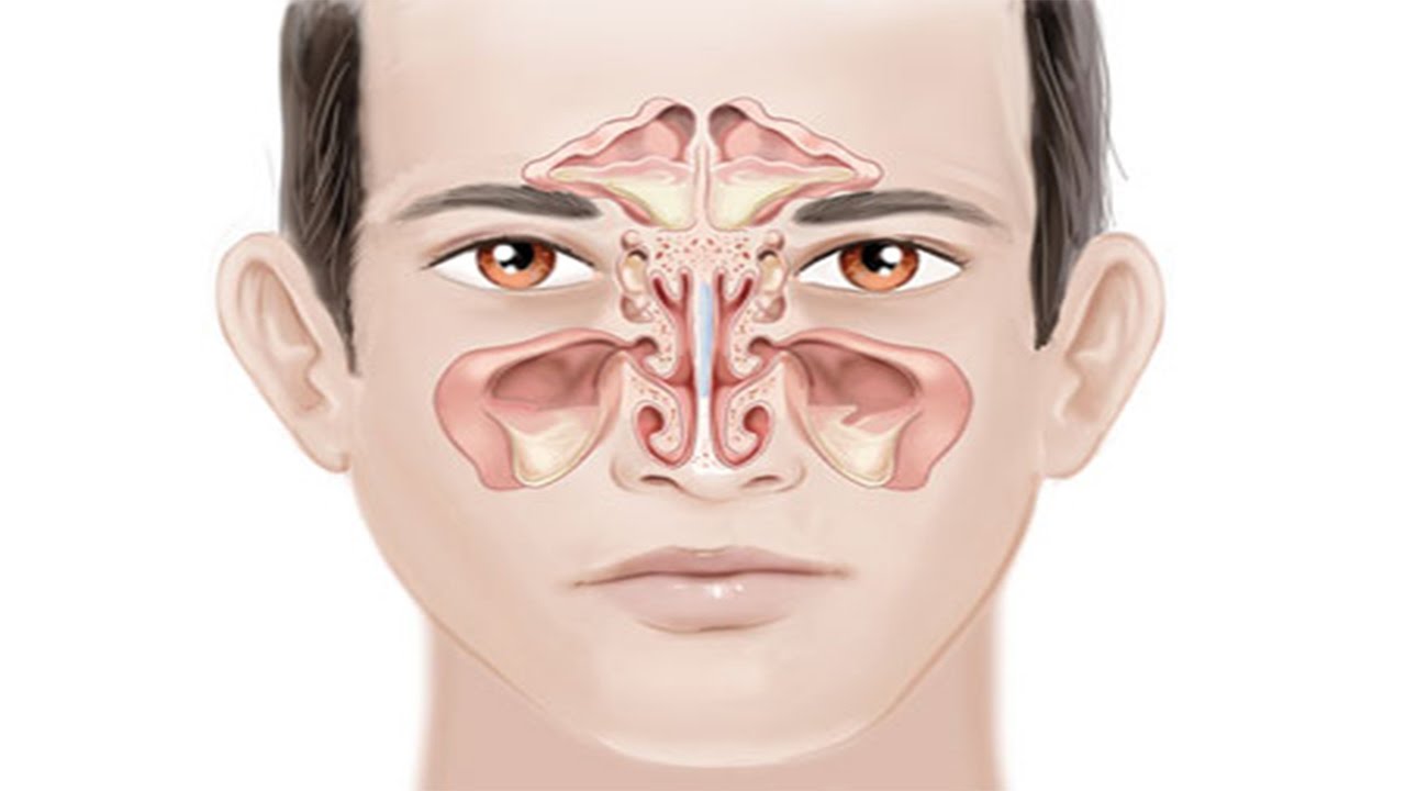 حساسية الجيوب الانفية - تحدث لنا خاصه في الشتاء 5035 1