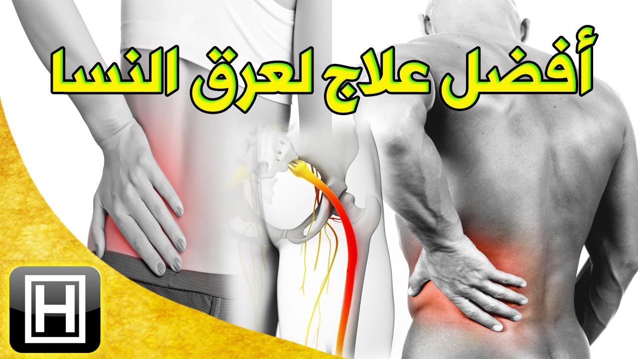 علاج عرق النسا بالاعشاب , الطب البديل لعلاج عرق النسا