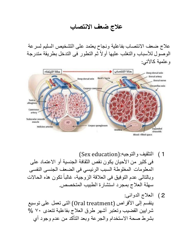 علاج عدم الانتصاب،حلول فعاله لانتصاب قوي 3558 3