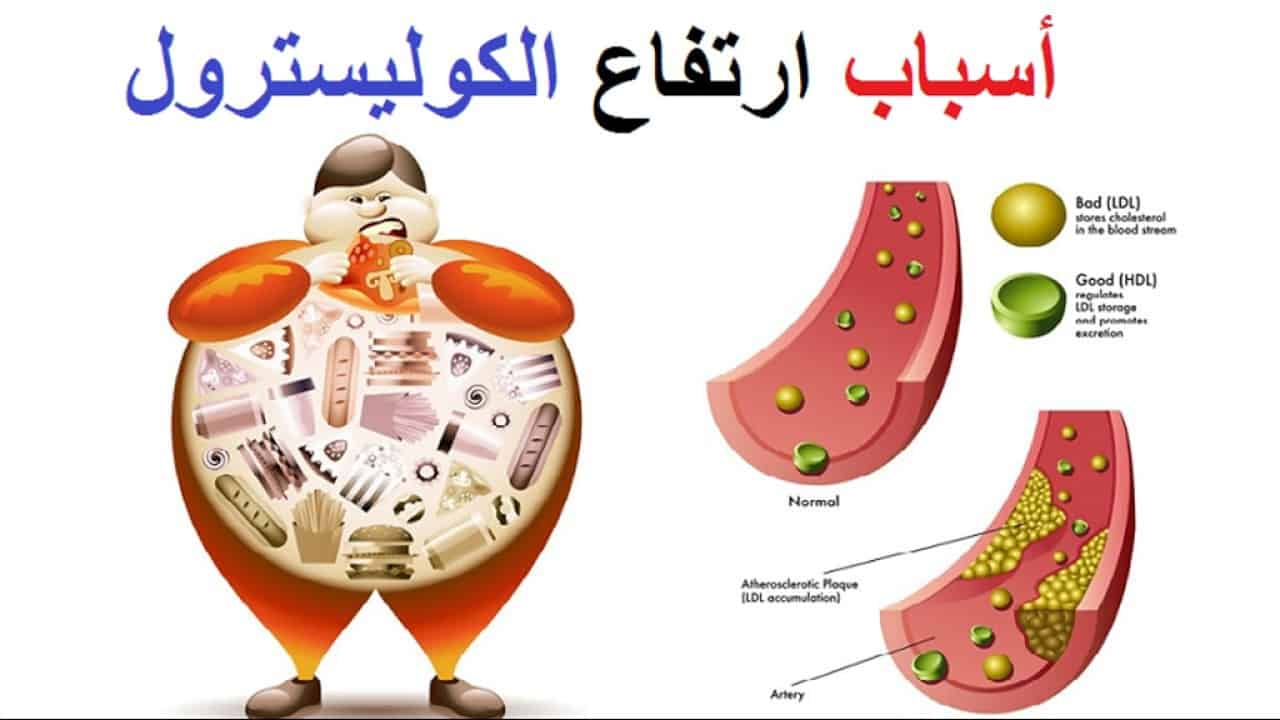 ما هو علاج الكولسترول , ادويه لخفض نسبه الكولسترول في الدم