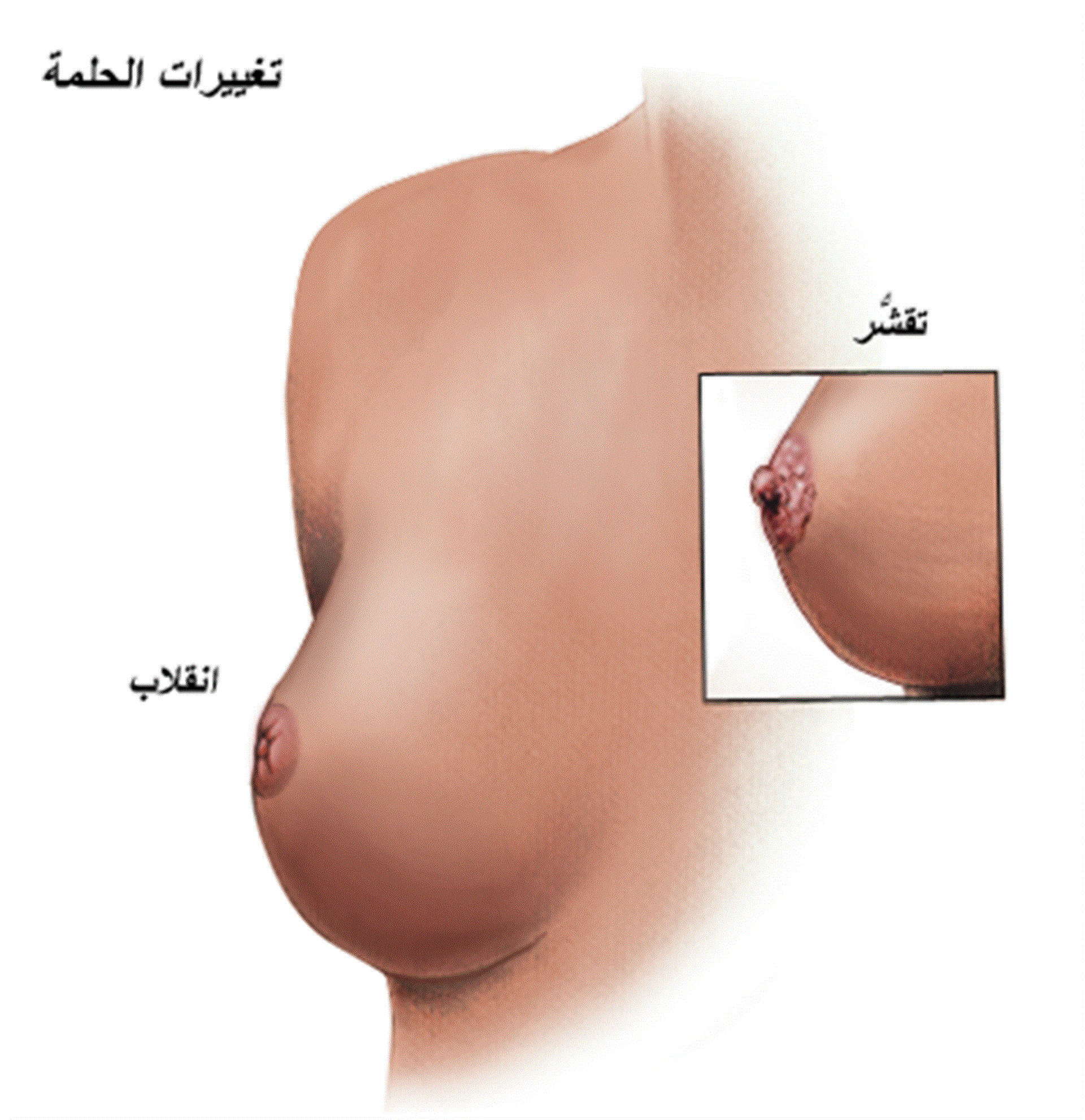 لون الحلمتين اثناء الحمل - تغيرات جسديه اثناء الحمل 6078 1