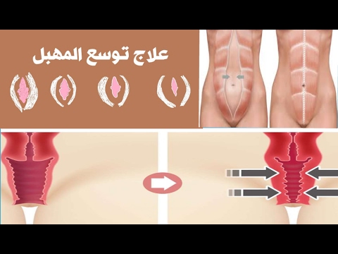 كيف يمكن تضييق المهبل بعد الولادة - طرق مختلفه لتضيق فتحه المهبل 2966 1