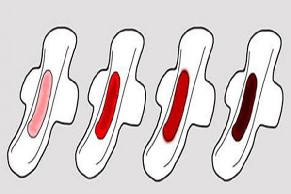الفرق بين دم الحيض والاستحاضة - هل الاستحاضة عند المراة امر طبيعى ام يستوجب استشارة الطبيب 2302 3