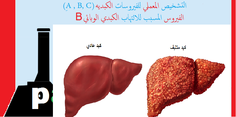 ما هو تحليل hbs , حقائق هامة حول تحليل hbs وما الغرض منه