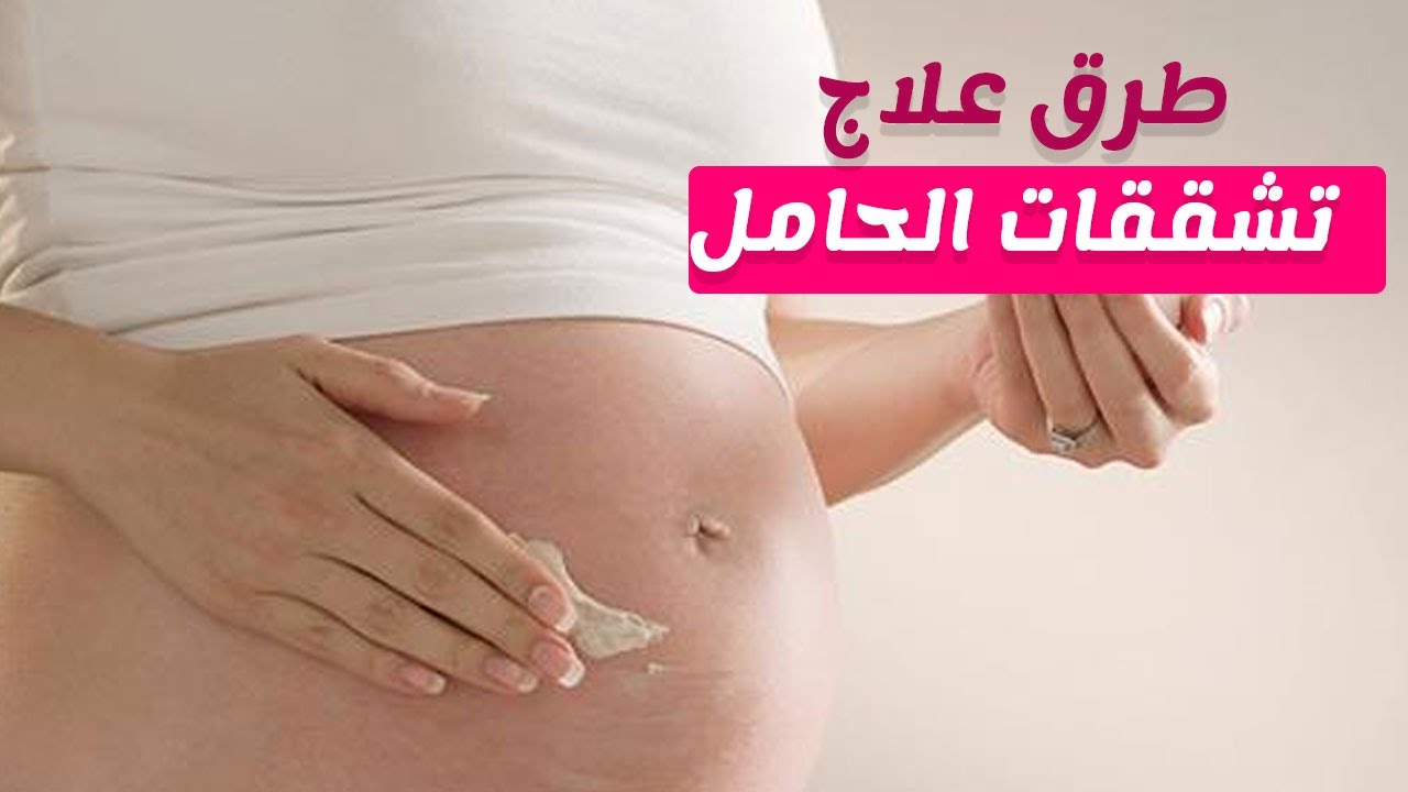 علاج تشققات البطن بالاعشاب - مهم كل سيدة بعد الولادة