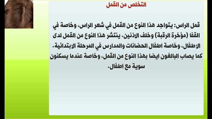 طرق التخلص من القمل , يوجد في كثير من الاطفال