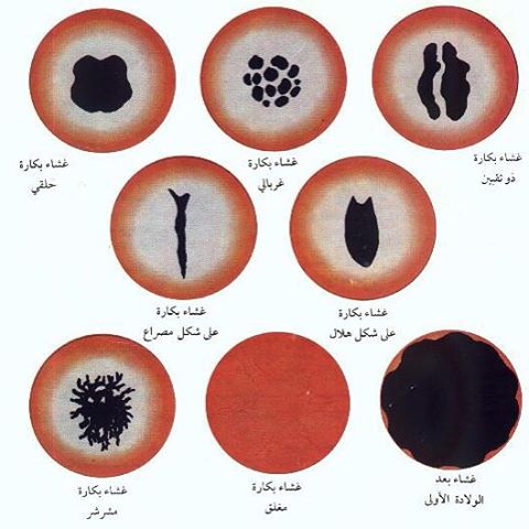 كيف تعرف البنت انها مازالت عذراء - معلومات هامة عن غشاء البكارة وعذرية الفتاة 2285 2