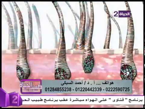 ازالة الشعر بالليزر من المناطق الحساسة - هل لازاله الشعر بالليزر اي اضرار 0 74