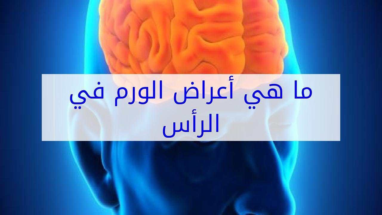 اعراض اورام الراس - كيف تعرف اورام الراس من الاعراض الاوليه 5879