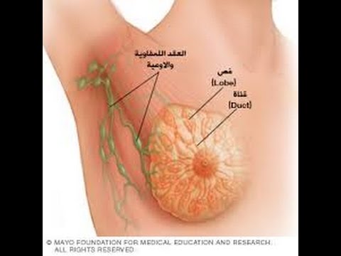 اعراض سرطان الثدي - علامات الاصابه بسرطان الثدي 0 101