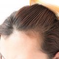4164 1-Jpeg علاج لتساقط الشعر مجرب - افضل علاج مضمون لسقوط الشعر راقيه مصطفى