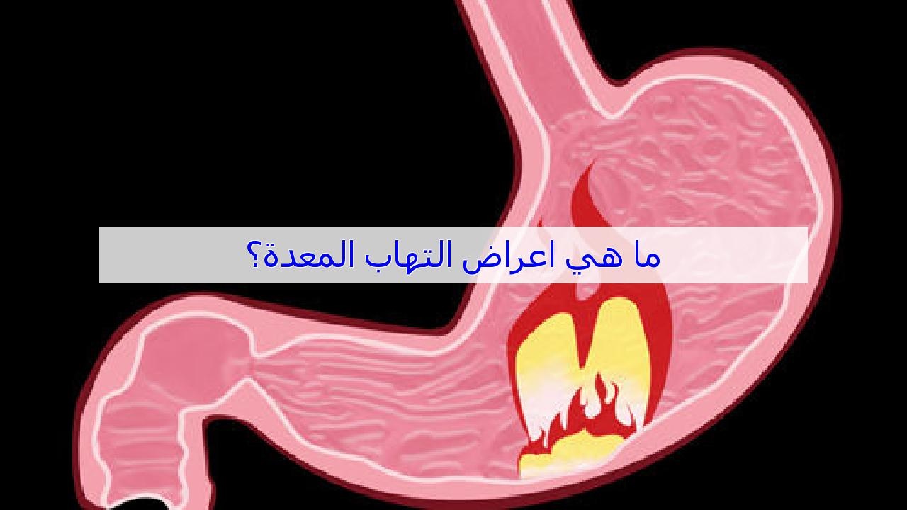 اسباب التهاب المعدة - لالتهابات المعده اسباب تعرف عليها 4290 1