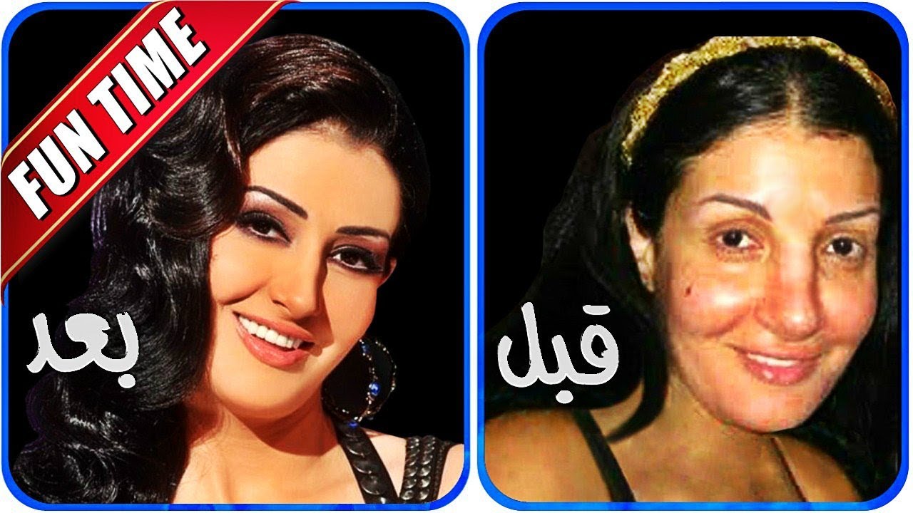 ممثلات كويتيات بعد التجميل وتنتقد المتنمرين