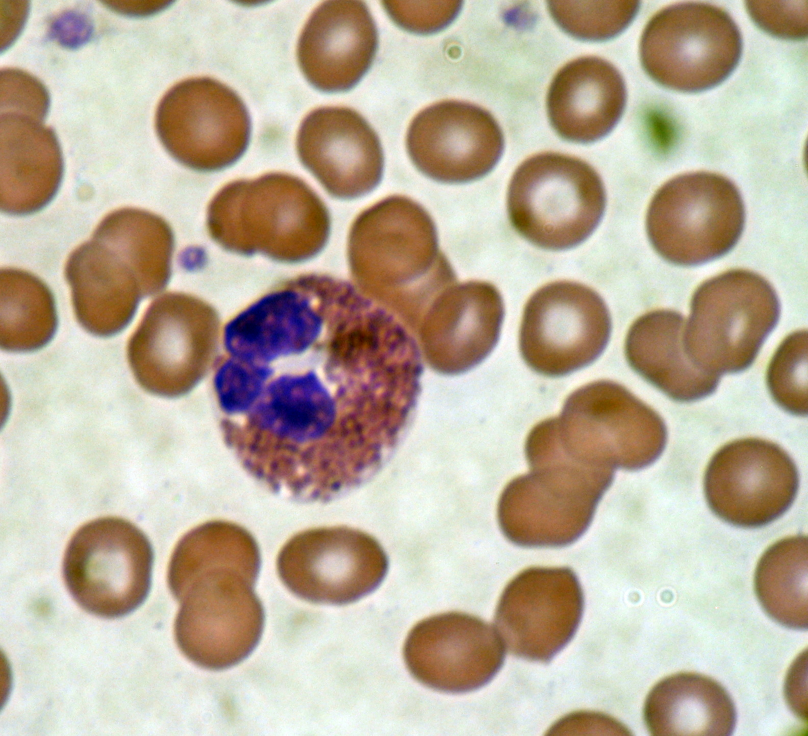 ما معنى leucocytes , كلمه leucocytes في تحليل البول