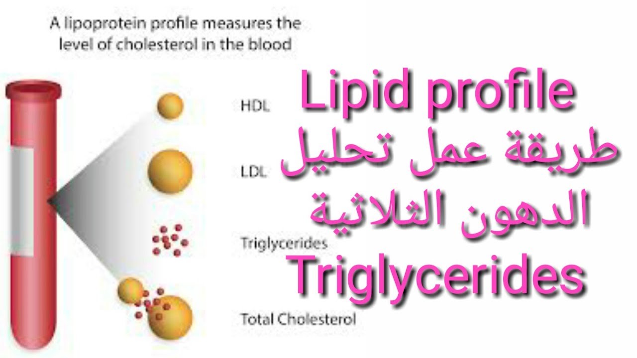 ما هو تحليل triglycerides , يعرفه معظم الاطباء