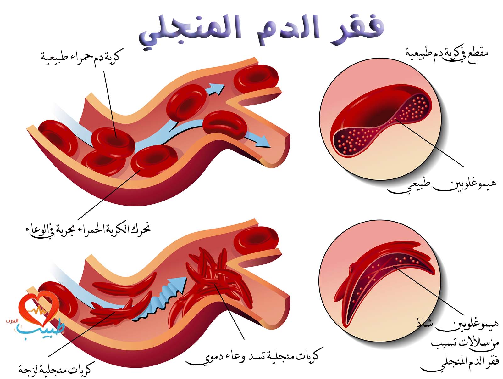 اسماء امراض الدم , انواع امراض الدم و اسمائها