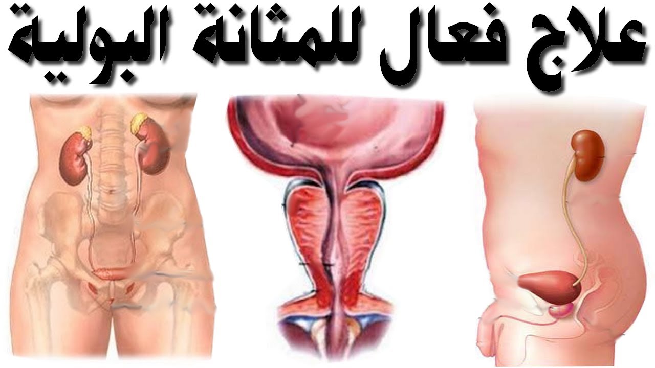 علاج التهاب المثانة للرجال , ادويه تقضي علي التهاب المثانه نهائيا