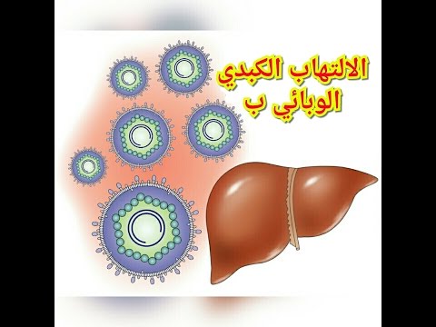 علاج فيروس الكبد , التهاب الكبد الوبائي تشخصيه وعلاجه